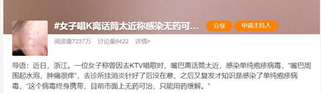热搜！女子KTV唱歌离话筒太近，感染无法根治的病毒！预防这样做