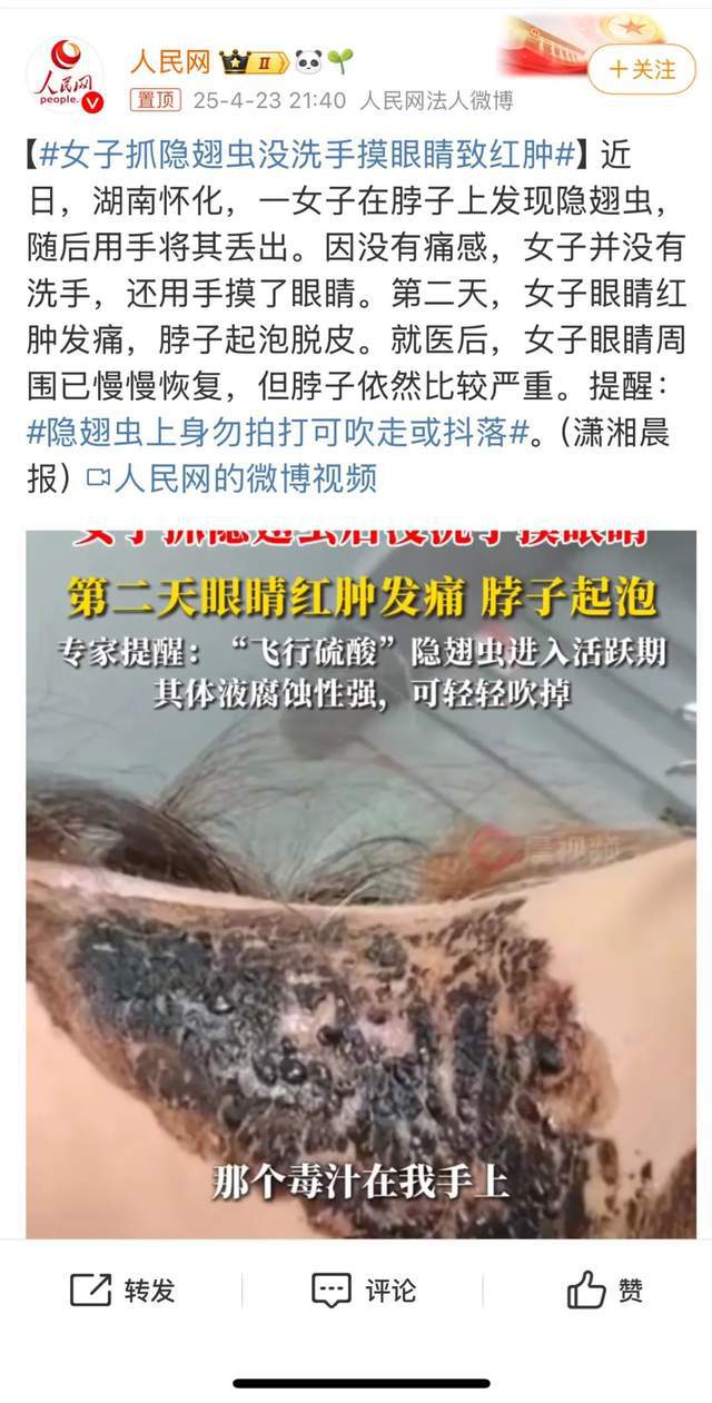 有人因此“毁容”！这种虫子很活跃，遇到不能拍！正确应对需一招