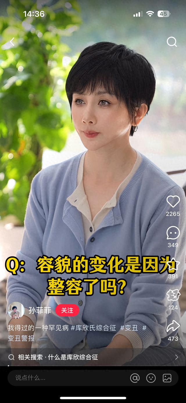 知名女演员回应“整容失败”：是患“库欣式综合征”