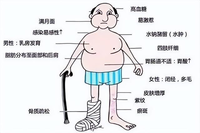 知名女演员回应“整容失败”：是患“库欣式综合征”