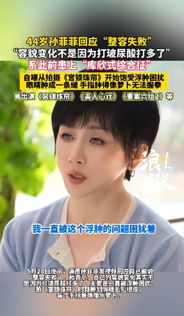 知名女演员回应“整容失败”：是患了这种病……