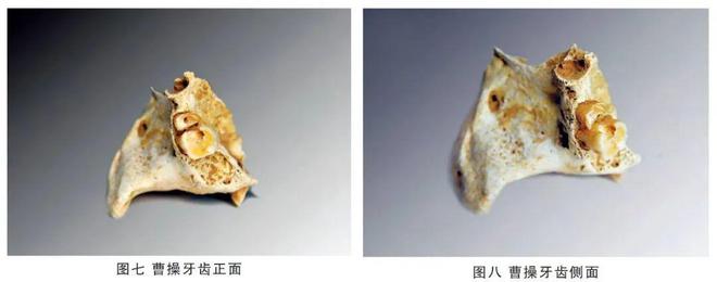 给曹操一盒布洛芬，能拯救他的头痛吗？