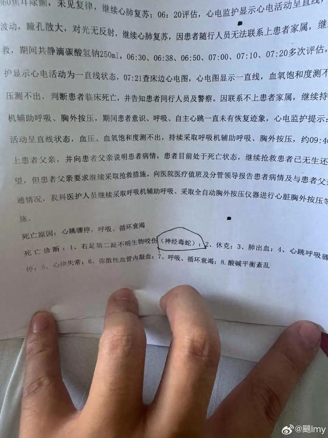 最新消息：确认为毒蛇咬伤！
