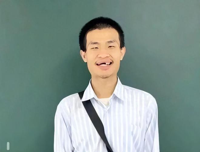 北大“韦神”牙齿问题引关注！很多人不重视这种会让牙齿掉光的病